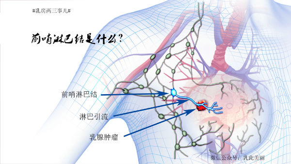 腋窝淋巴结清扫后图片图片