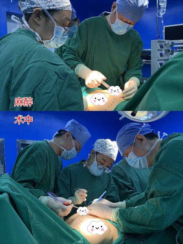 双环提升乳房手术图片图片