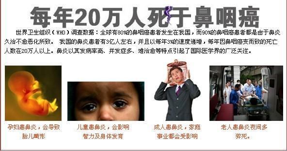 鼻炎久治不愈会发展成为鼻咽癌吗