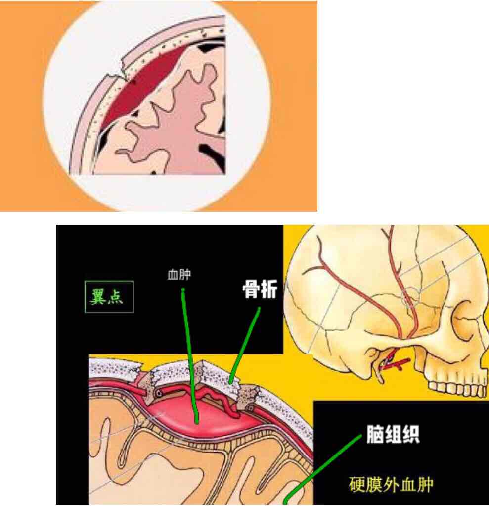 傷及