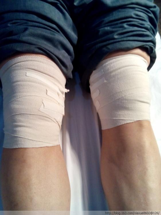 骨质增生的原因有哪些?医生提醒:注意5点,重了住院就划不来了