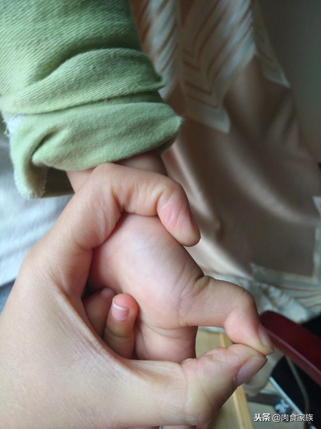 会,但确实会发生,有些孩子出生就像成年人的狭窄性腱鞘炎晚期表现,也