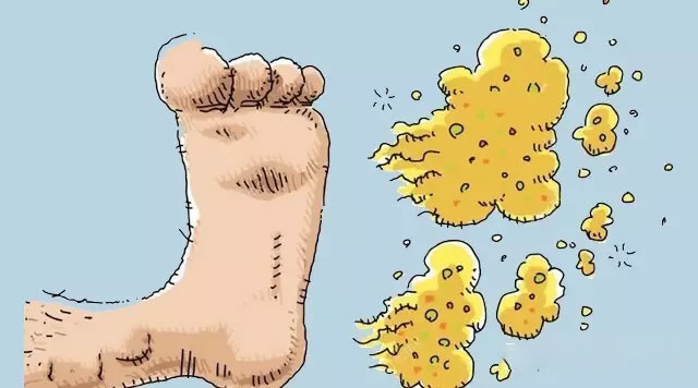 恶痒难忍的脚气你拿它没辙了