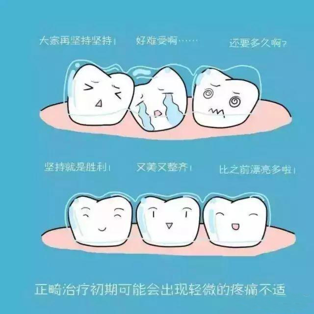 牙齿矫正过程中的这些小细节你注意了吗