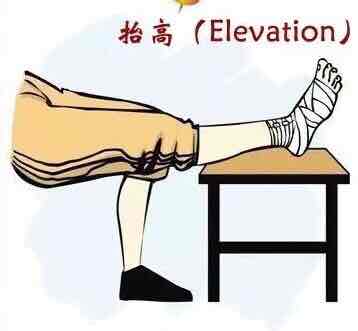 踝关节扭伤那些事儿