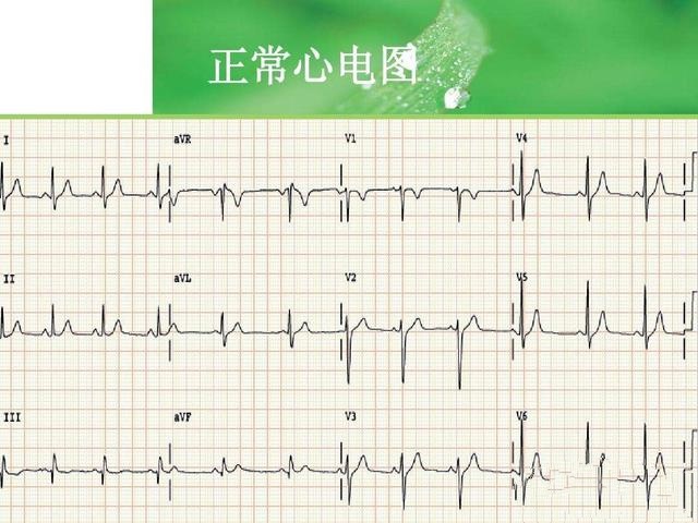 經常心慌身體沒勁心電圖查不出原因正常到底是怎麼回事