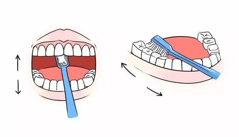 bass刷牙法 bass刷牙法,又称水平颤动法, 是去除邻间隙菌斑,且不伤及