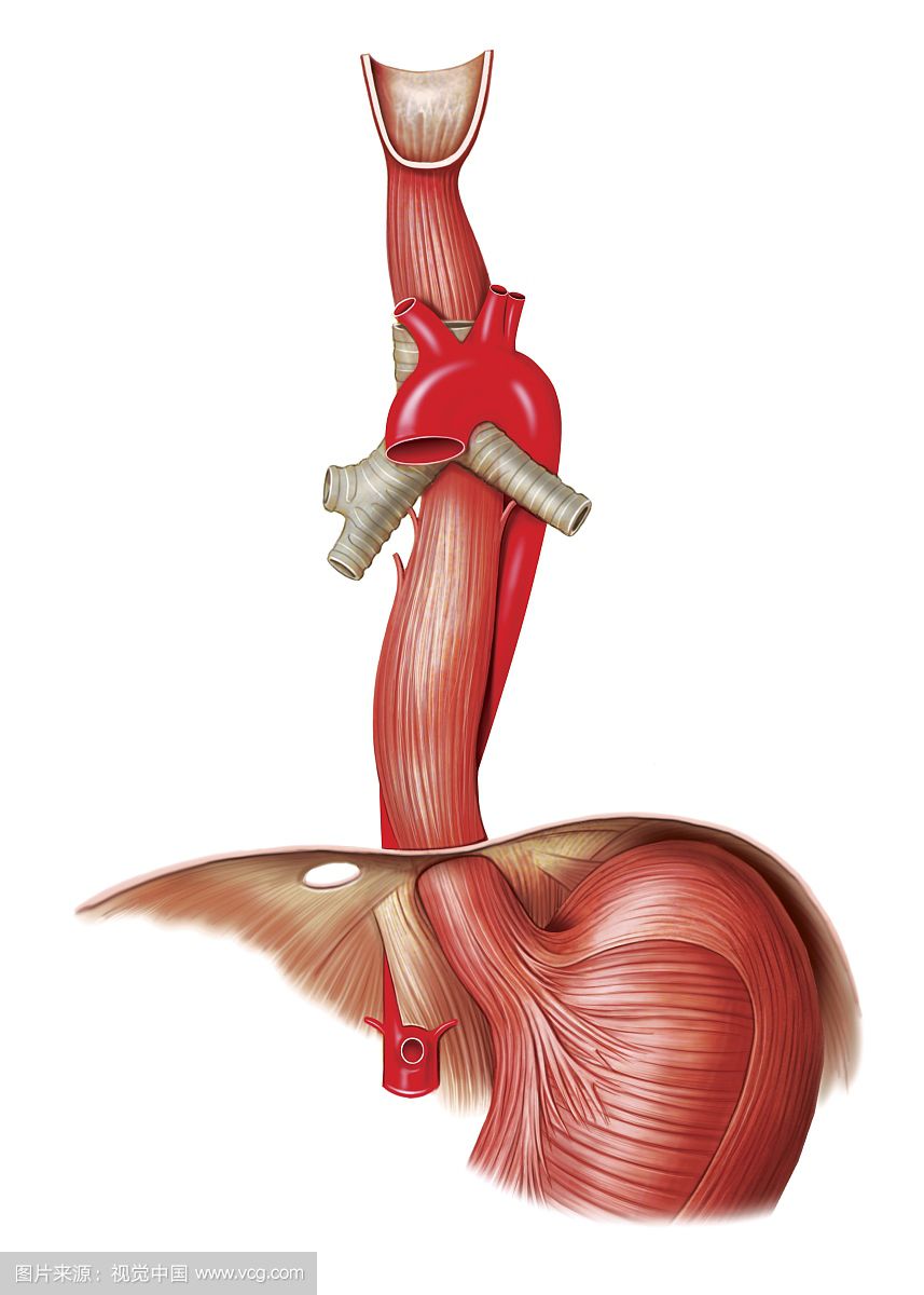 食管生理狭窄图片
