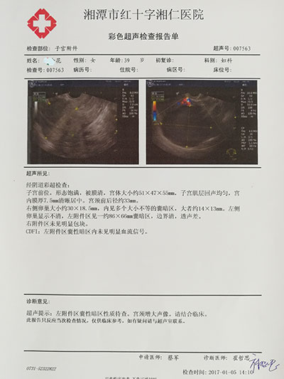 子宮內膜異位症根治的最佳辦法是生孩子