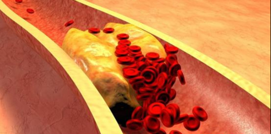 40岁后睡觉出现这4种情况可能是血管堵了占1个您也要