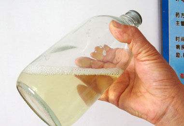 原创北大男科专家辟谣观察尿液并不能发现前列腺炎