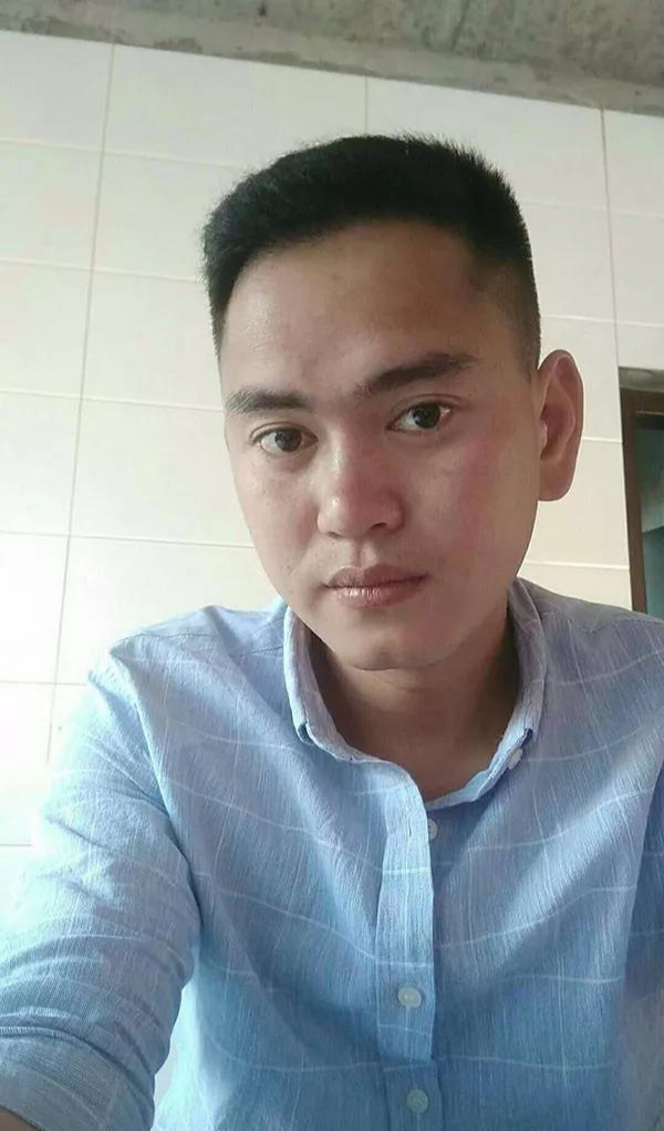 脱发自卑怕照相植发3750单位变帅迷上自拍