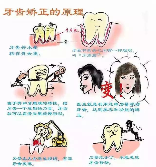 托槽掉了怎么办?