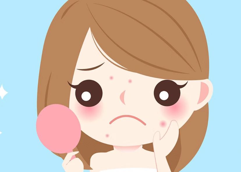 长痘痘怕吃药,怎么办?