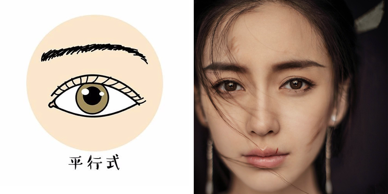 双眼皮最全攻略,这些关键点不清楚等于白做!
