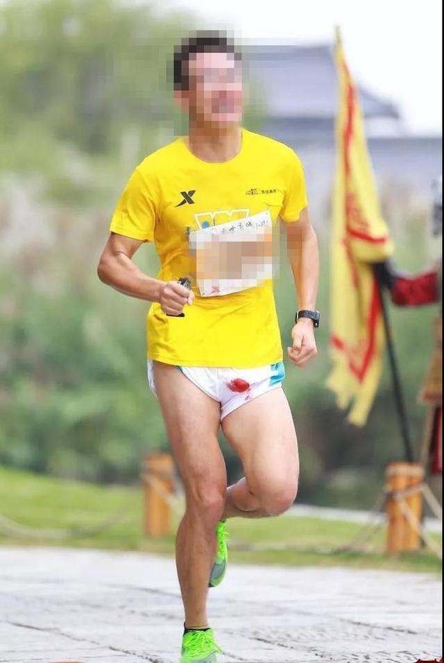男子跑马拉松关键部位磨破