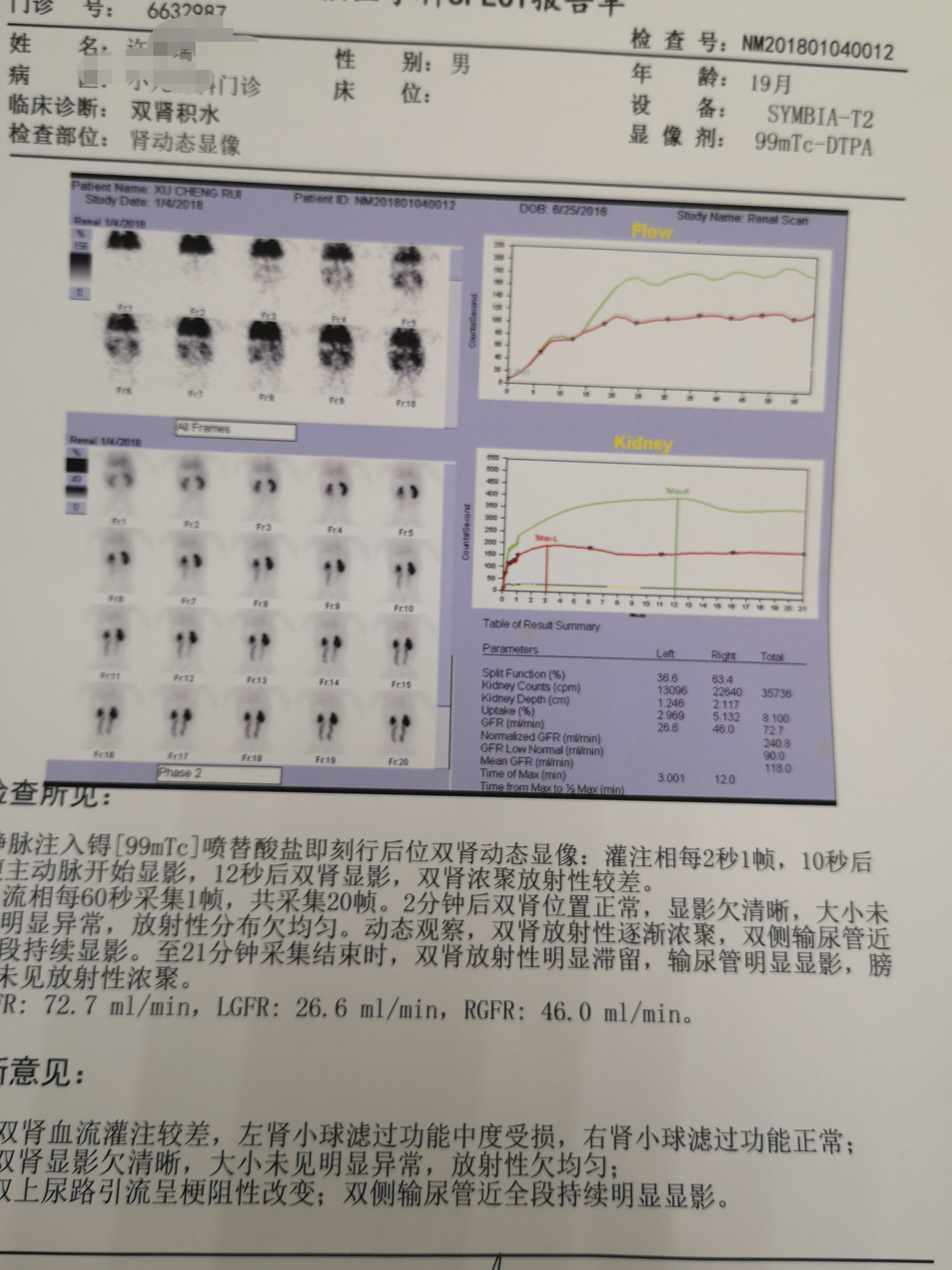 闲聊肾动态核素扫描
