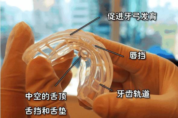 这是孩子成长过程中最有价值的投资——mrc儿童早期干预性矫正