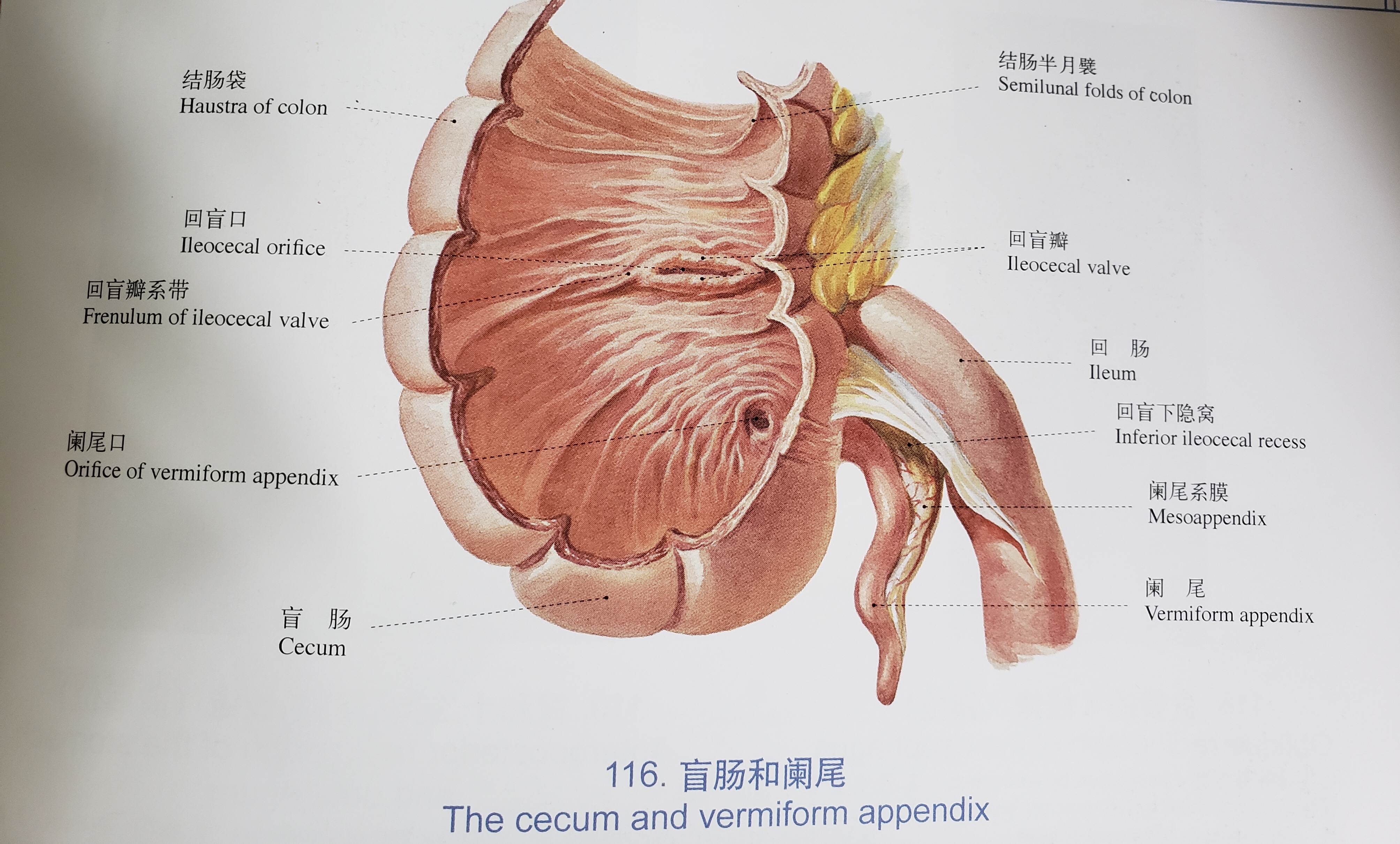 阑尾手术解剖结构图片