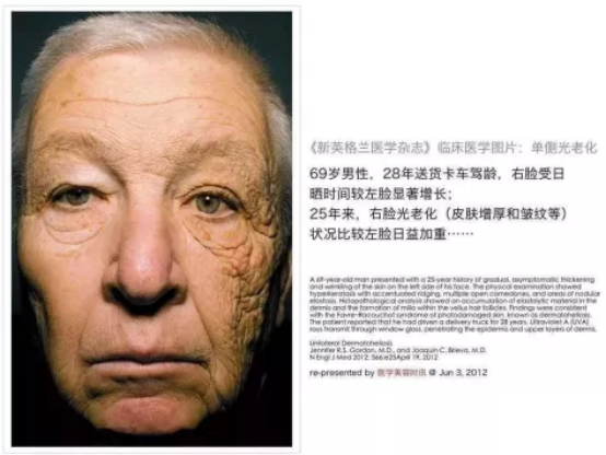 你了解防晒的重要性吗 王玮蓁主任医师 爱问医生