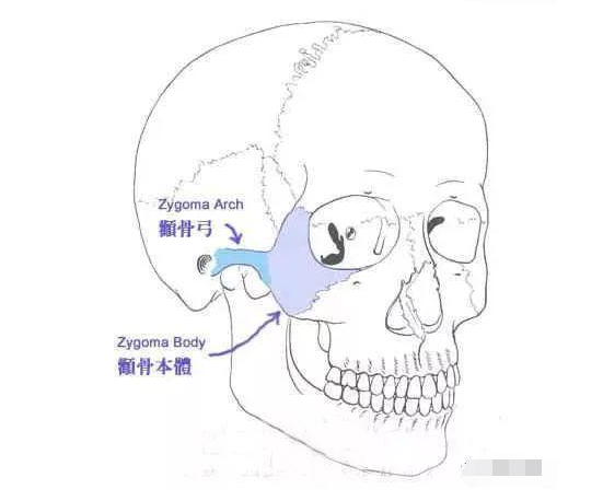 颧骨解剖图片