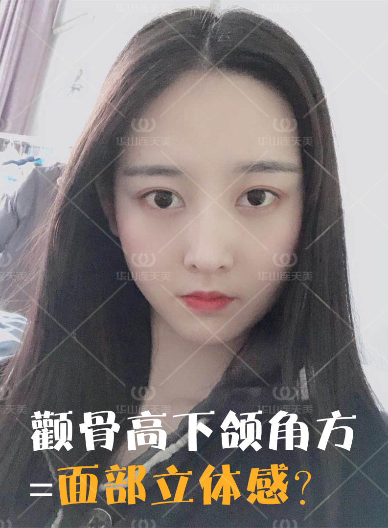 颧骨高下颌角方面部立体感