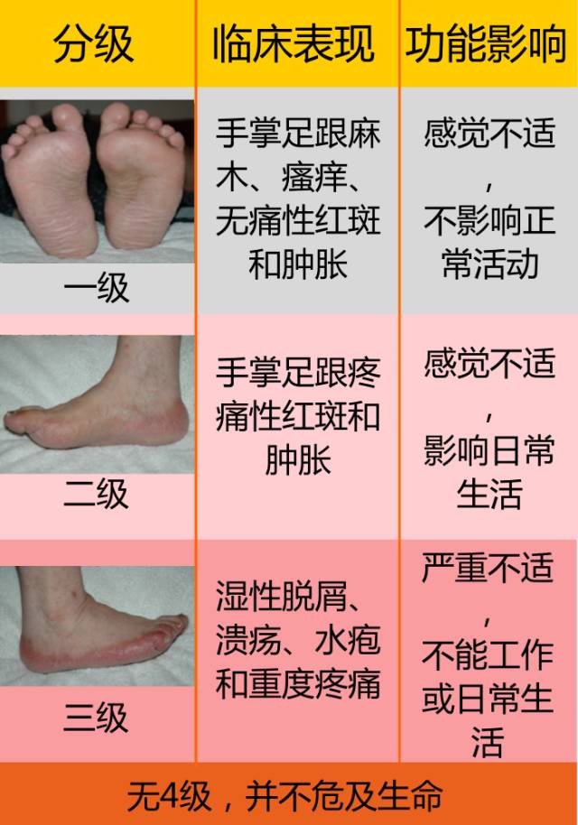 手足综合症也有严重程度的分级,一般分为三级手足综合症是一种较为