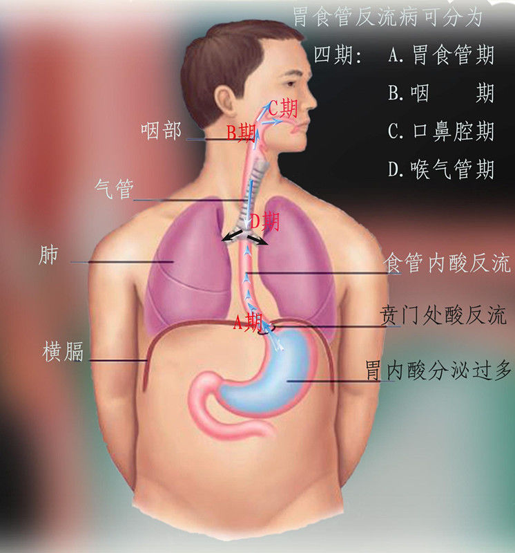 食管炎胸疼哪个位置图图片