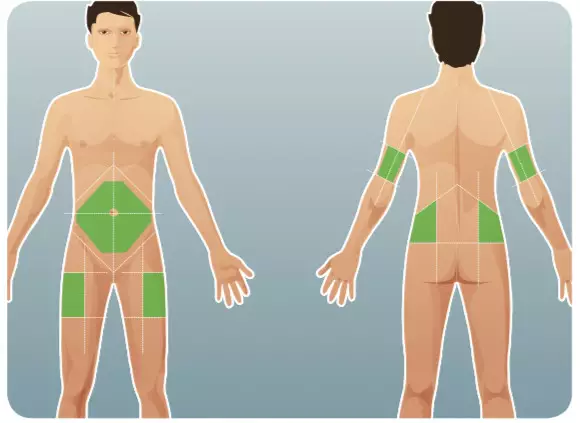 關於胰島素注射部位需要注意的幾個方面