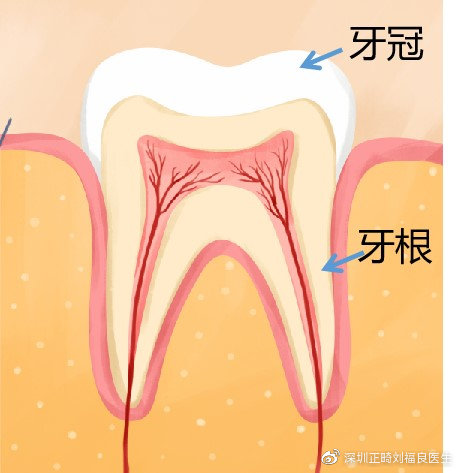 牙根颈图片