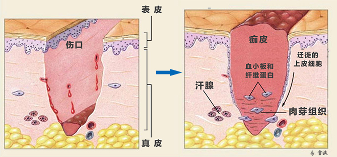 把痂皮抠掉了啊…控制不了我寄几啊就忍不住手贱啊伤口结痂后经常擦伤