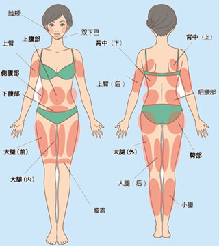 吸脂手术十大常见问题解答下