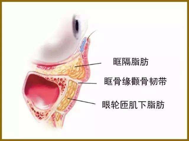 眶隔脂肪在哪里图片