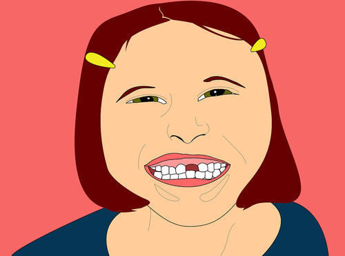 种植牙会影响脸上表情吗?