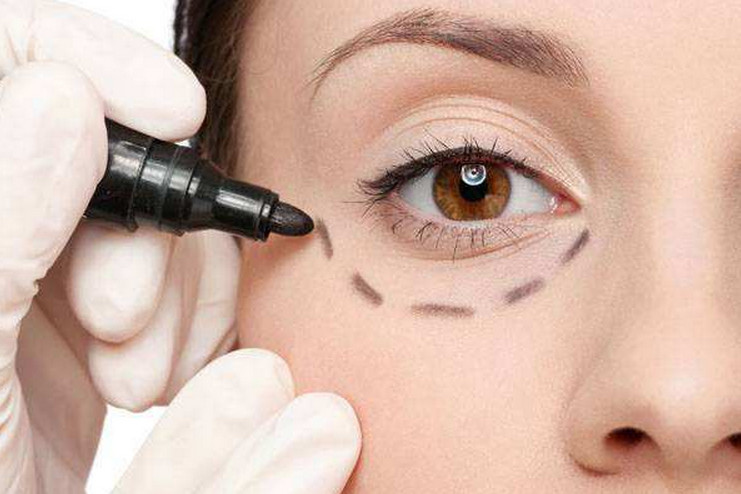 经常熬夜眼袋会越来越大