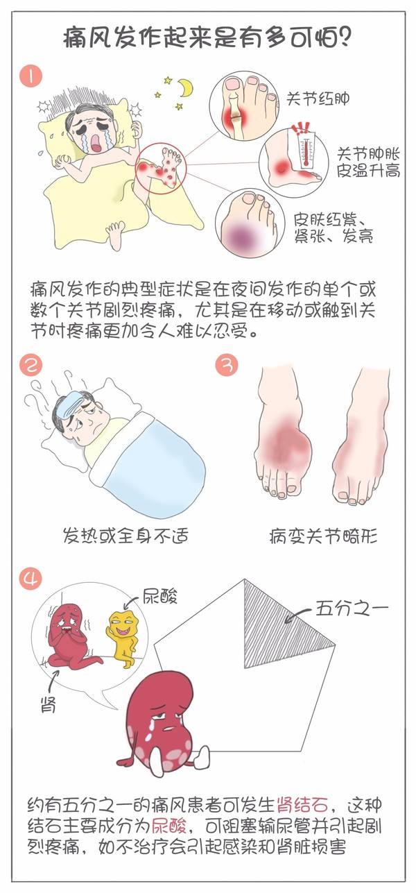 痛风与高尿酸血症——我们不一样!
