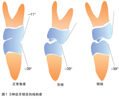 自测:你的咬合关系正常吗?