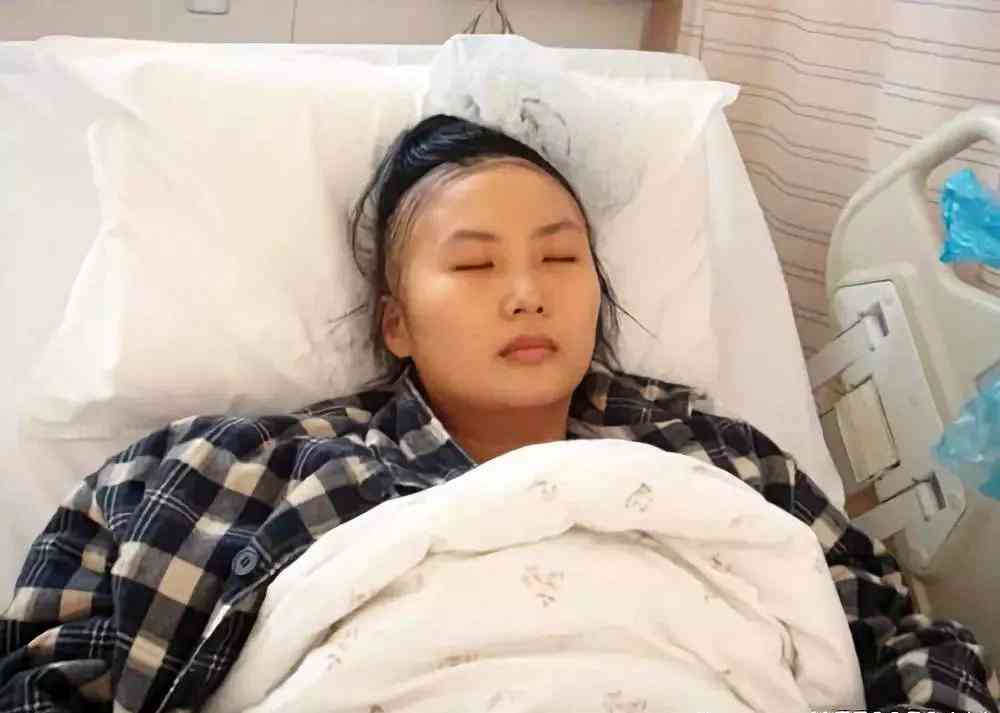 病中的于娟(图源:微博@复旦教师抗癌记录)