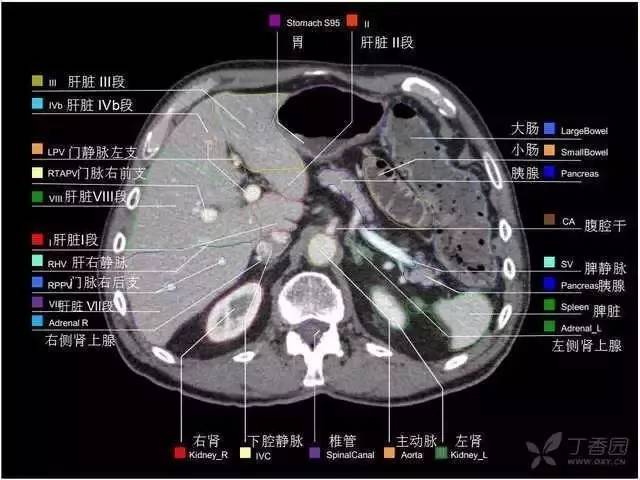 医学笔记︱高清版腹部CT：（上）