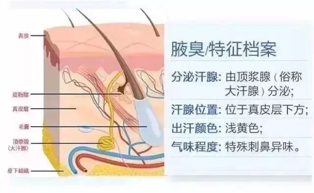 腋臭俗称狐臭,它的产生与大汗腺(也叫做顶泌汗腺,顶浆腺)的液体分泌过