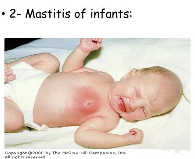 78如何避免老人和新手爸妈带宝宝的时候出现严重护理错误:1.