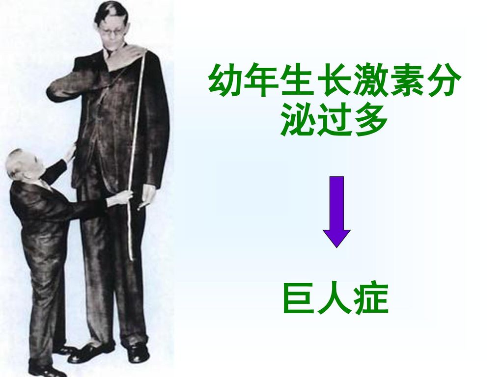 分泌生长激素过多,引起软组织骨骼及内脏的增生肥大及内分泌代谢紊乱