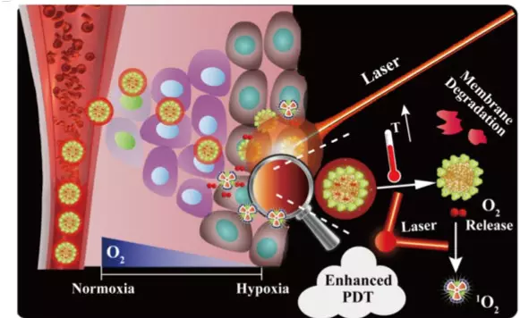 瘢痕疙瘩的新型治疗光动力治疗