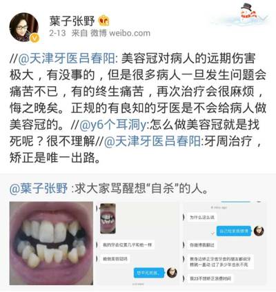 羡慕刘涛一口白牙?先看看她“美容冠”血泪史…