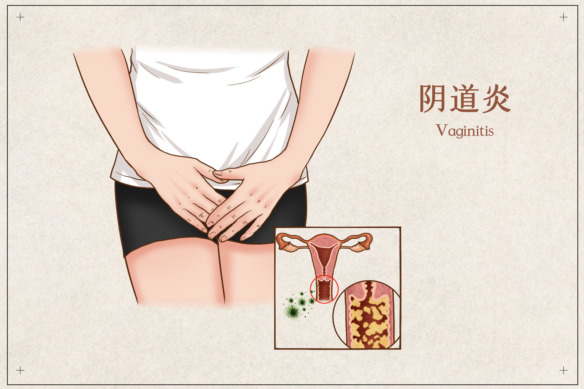 有没有妇科病看你内裤就知道了