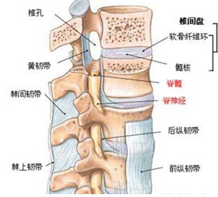 腰椎间盘突出不等同于腰椎间盘突出症