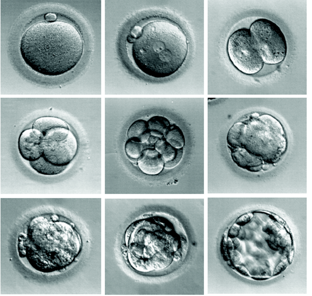 怀孕初期胚胎图片