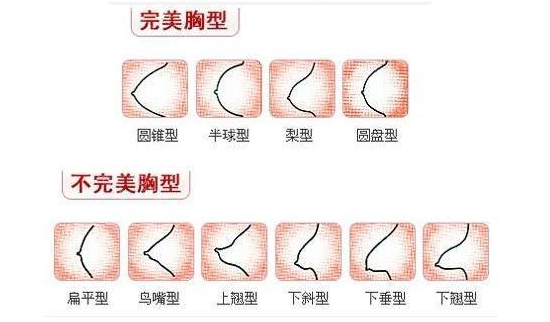 假体丰胸术适应对象:乳房萎缩,轻度下垂,发育不良而导致的扁平等求美