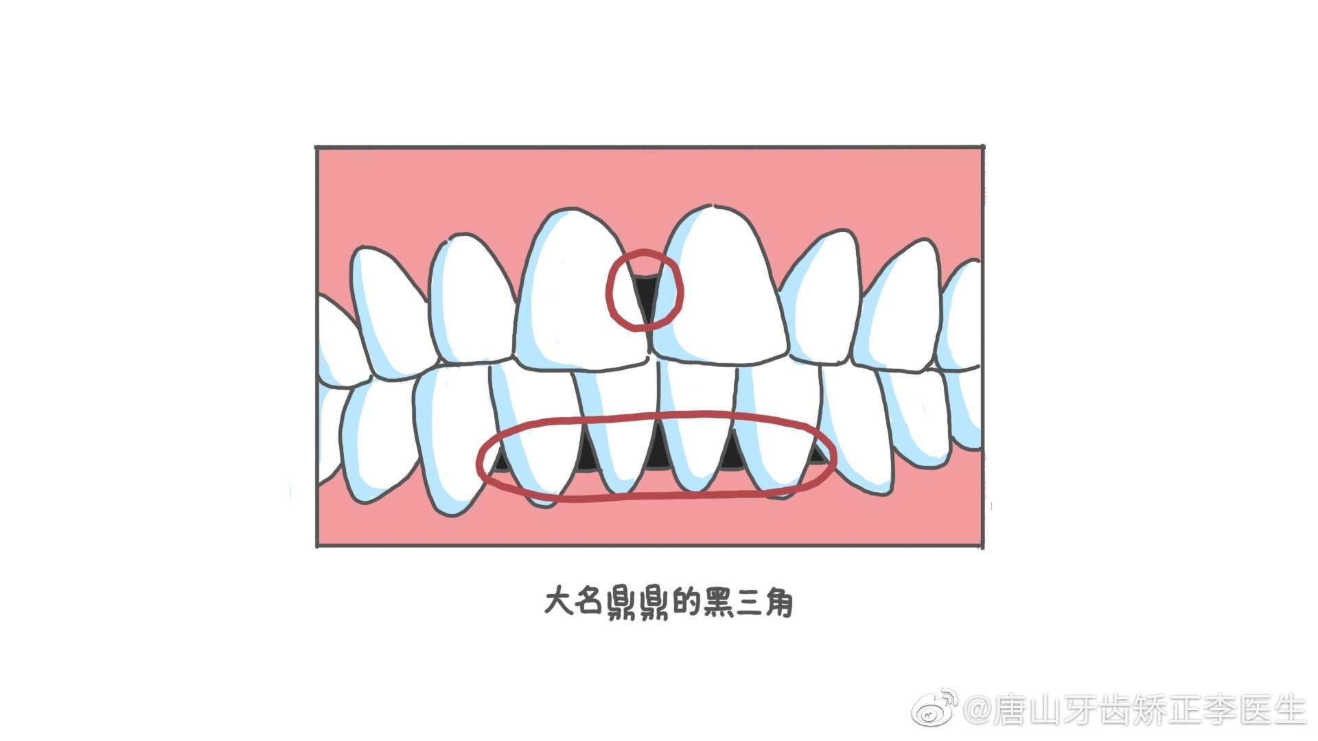 孕妈妈注意：怀孕期间口腔护理很重要！-爱康健齿科