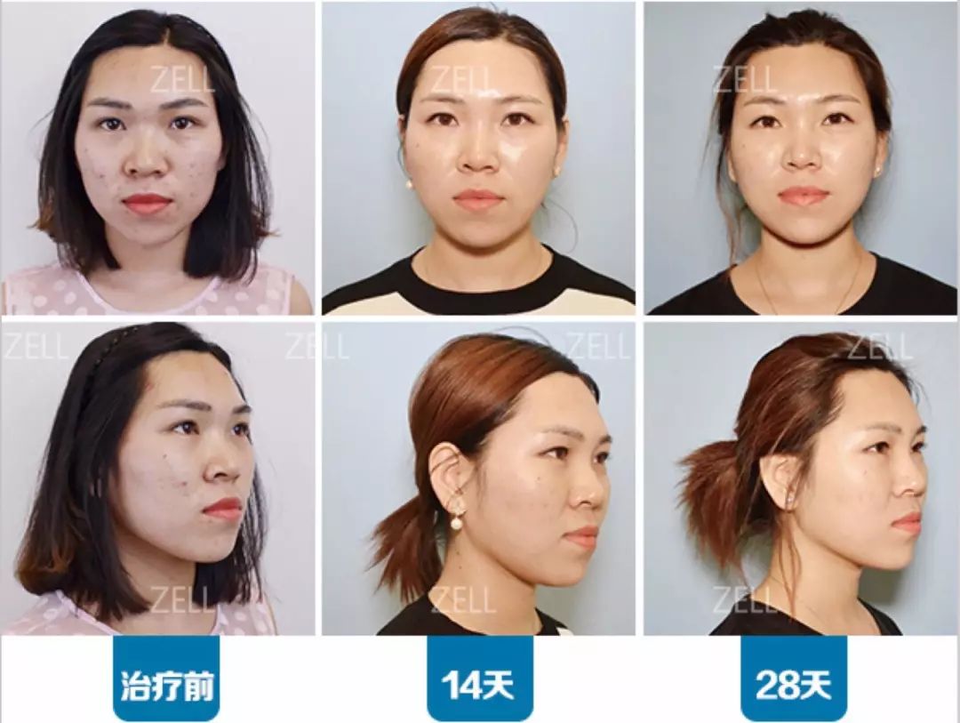 朗格线雕 <wbr> <wbr>| <wbr> <wbr> <wbr>一线提拉，放缓时光步伐